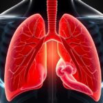 Anatómiai ábra a rekeszizomról és a tüdőről, a légzés folyamatához kapcsolódóan.